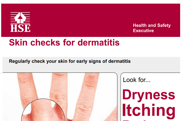 HSE Skin posters image