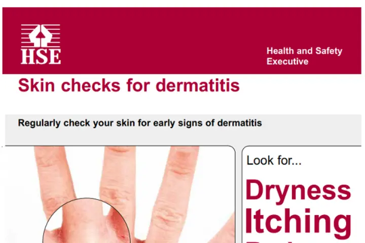HSE Skin posters image